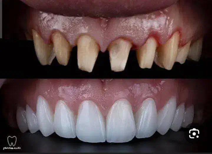 دندان سازی ویتا خدمات و ساخت دندان|پزشکی|بابل, |دیوار