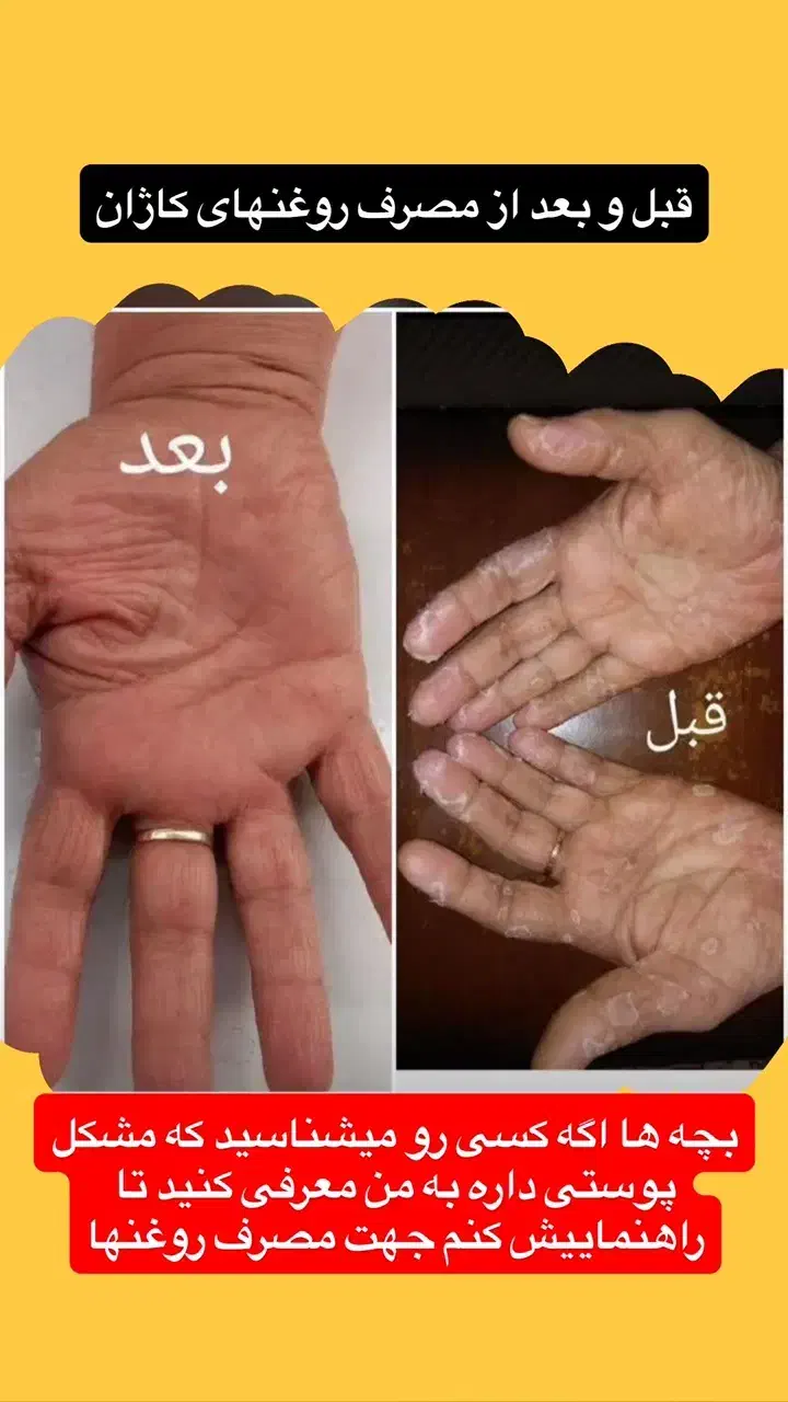 ۲۰روز درمان|آرایشی، بهداشتی، درمانی|بم, |دیوار