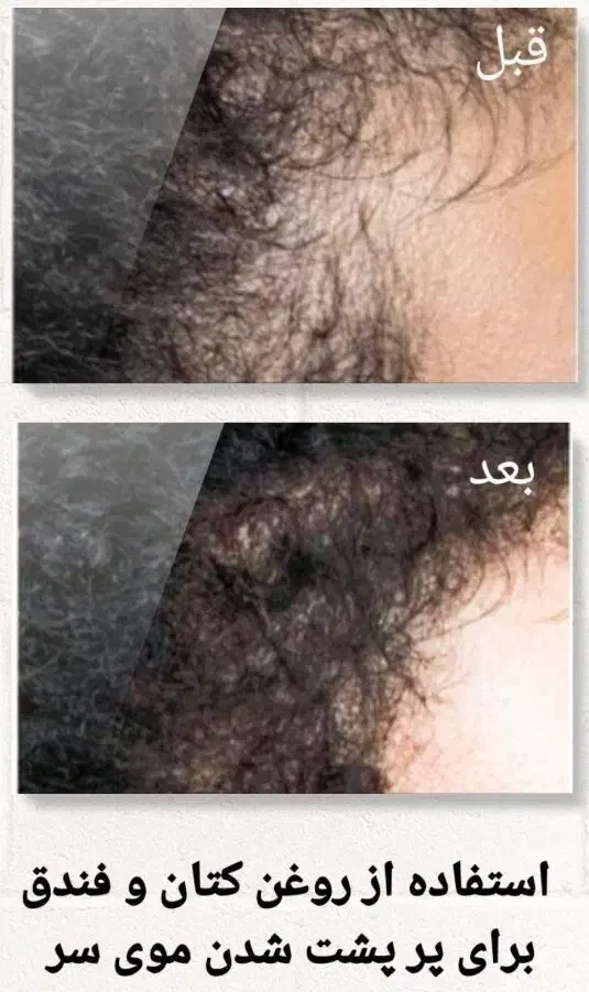 محصولات شرکت نیوشانیک|آرایشی، بهداشتی، درمانی|تهران, شهرک امام خمینی|دیوار