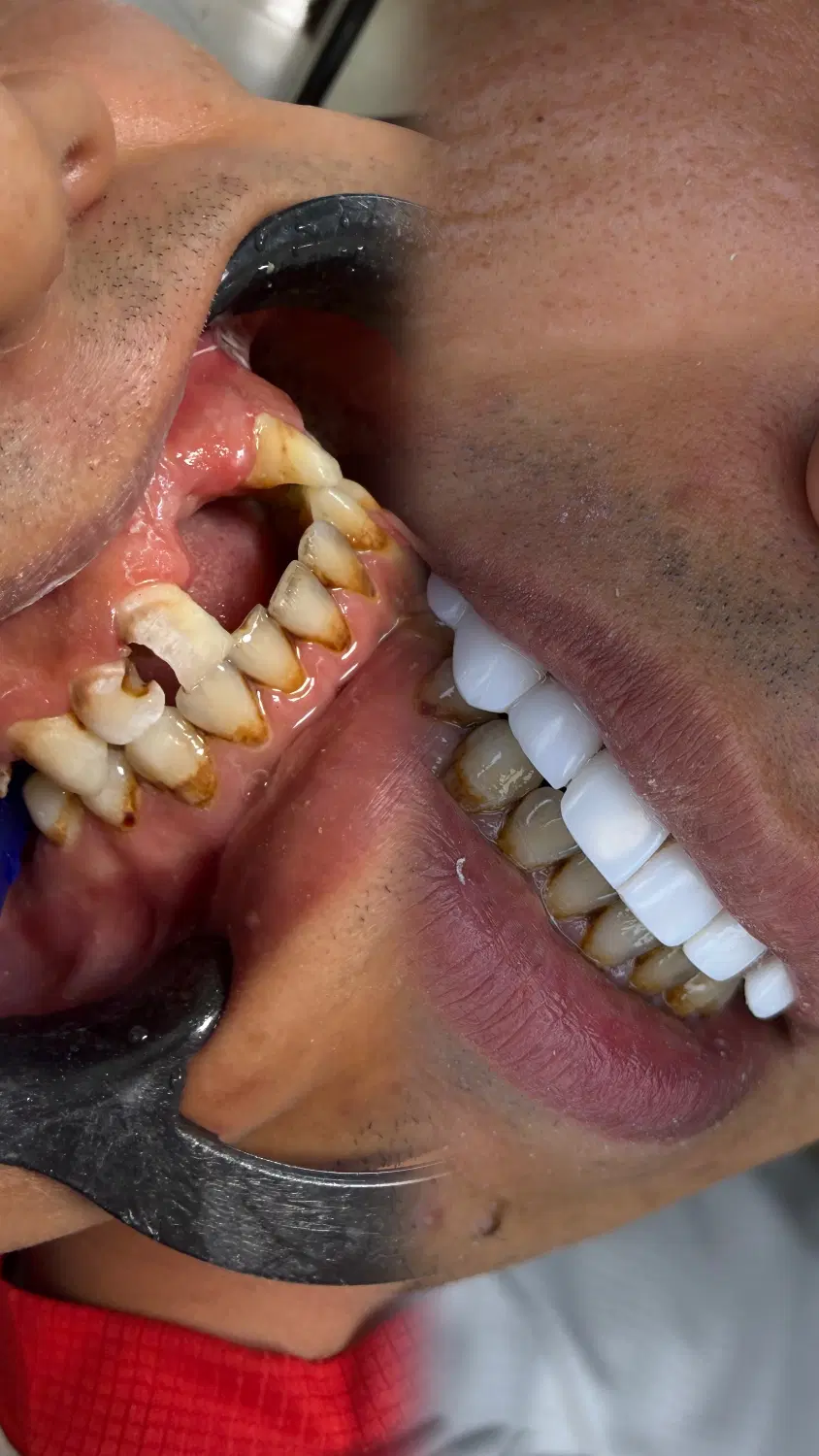 کلینیک دندان پزشکی،کاشت ابرو،ژل|خدمات زیبایی و سلامت|اهواز, کوی ملی راه|دیوار