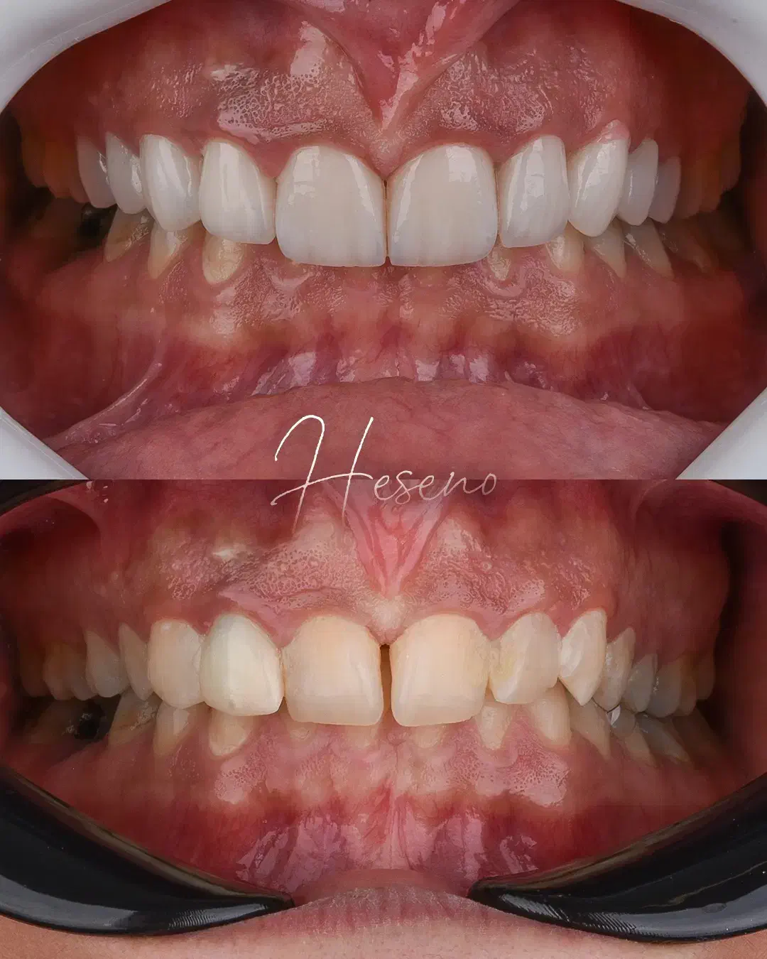 ایمپلنت و لمینیت اقساطی ( فولادشهر )|خدمات آرایشگری و زیبایی|فولادشهر, B2|دیوار