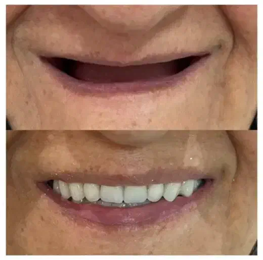 لابراتوار دندانسازی سبز|پزشکی|نسیمشهر, |دیوار