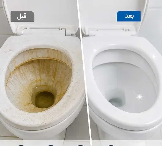 جرمگیری توالت ایرانی و فرنگی ،پاک شدن زردی و جرم|لوازم سرویس بهداشتی|تهران, جنتآباد جنوبی|دیوار