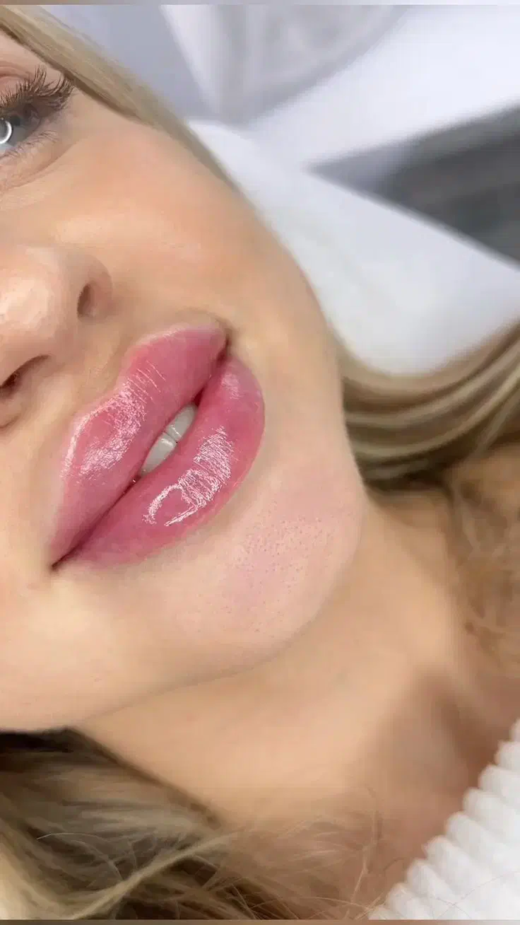 ۵۰٪تخفیف ویژه کلینیک نورا|خدمات آرایشگری و زیبایی|محمدشهر, محمدشهر|دیوار