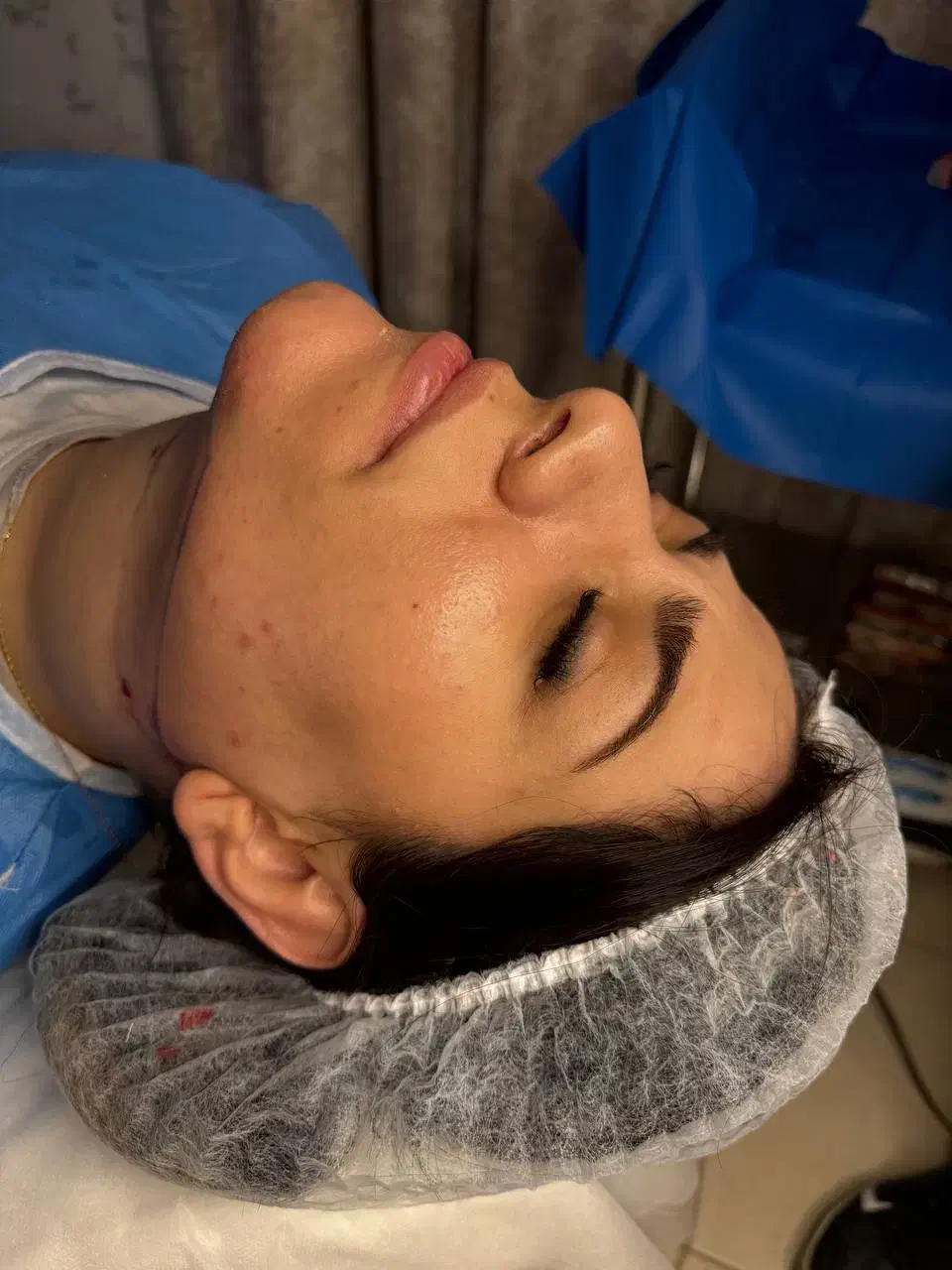 ساکشن غبغب|خدمات آرایشگری و زیبایی|پرند, فاز ۲|دیوار