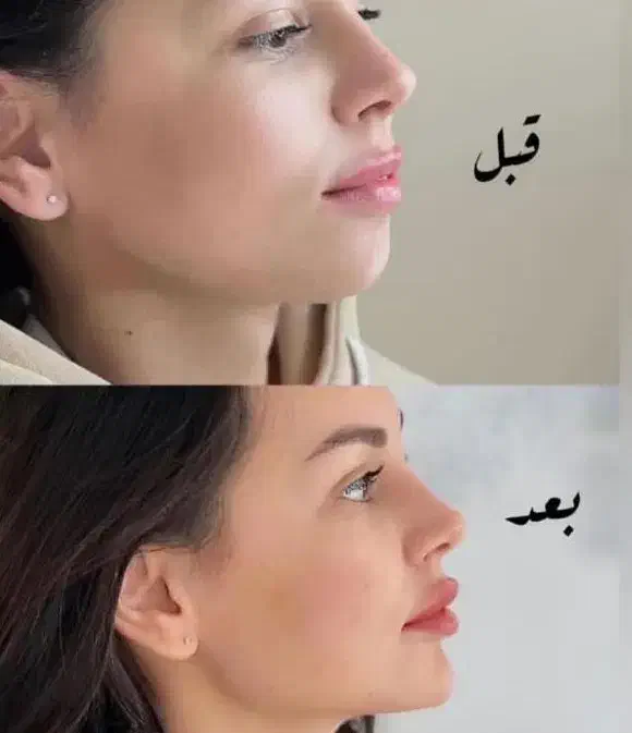 کلینیک تخصصی  خدمات زیبایی(ژل و بوتاکس ) با تخفیف|خدمات آرایشگری و زیبایی|کاشان, فین کوچک|دیوار