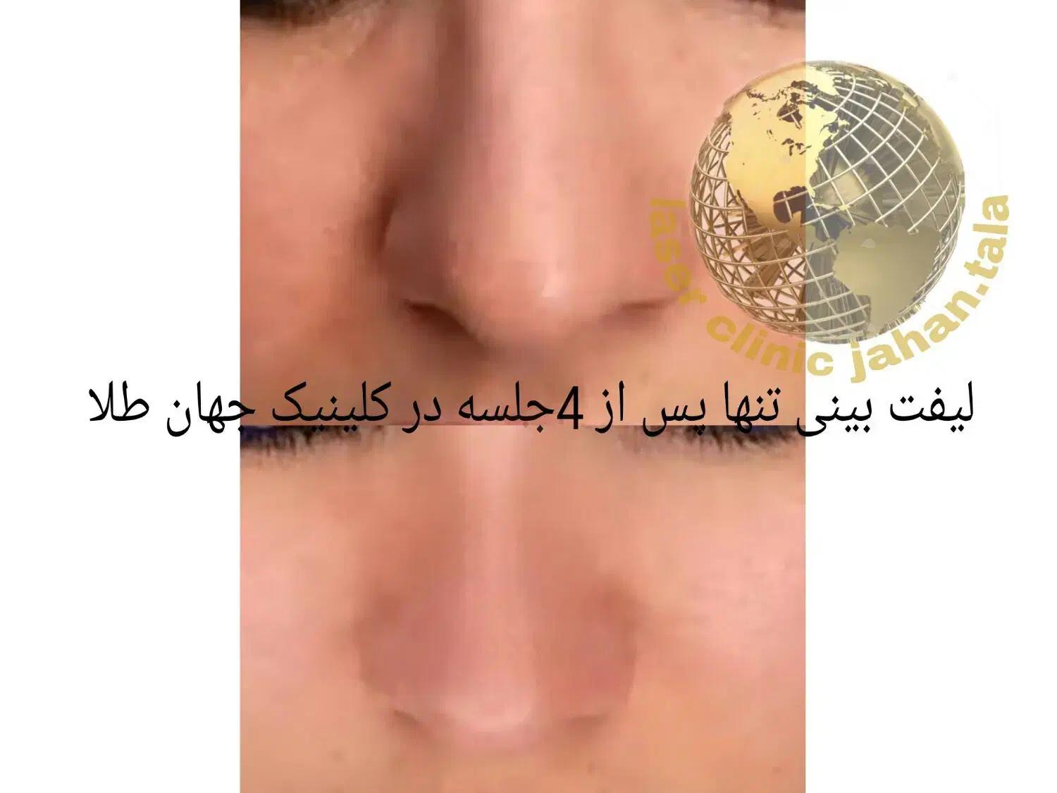 کلینیک لیزر پوست،مو جهانطلا در کرمانشاه (فوتونا)|خدمات آرایشگری و زیبایی|کرمانشاه, |دیوار