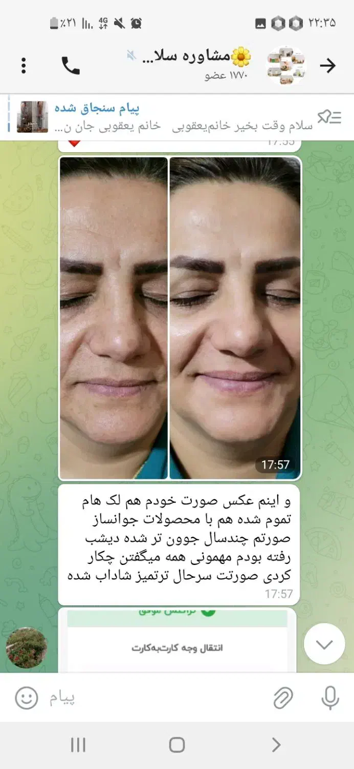 پوستت هلوی با تکسو|خدمات آرایشگری و زیبایی|کرمان, |دیوار