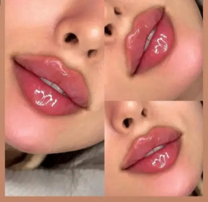 تزریق ژل فیلربوتاکس تخفیفات50درصدی برای زیباجویان|خدمات آرایشگری و زیبایی|زاهدان, |دیوار