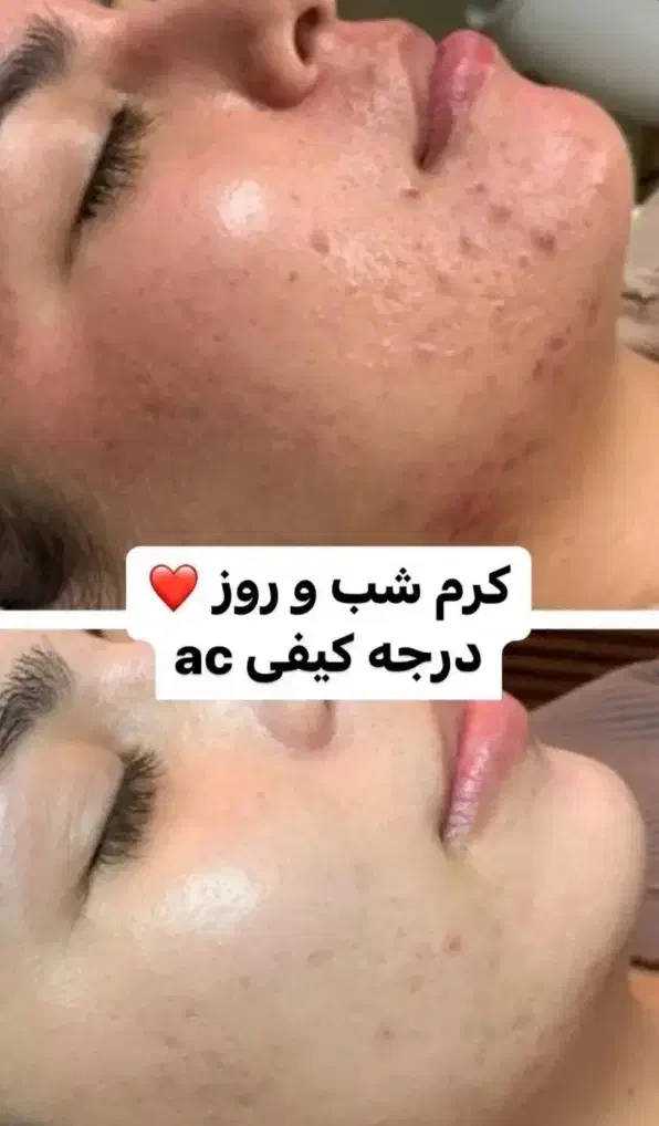 کرم شب و روز|آرایشی، بهداشتی، درمانی|اسلامآباد غرب, |دیوار