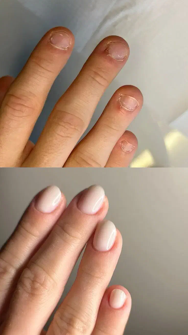 کاشت ناخن فرصت ویژه برای کسب درآمد|خدمات آموزشی|خرم‌آباد, |دیوار