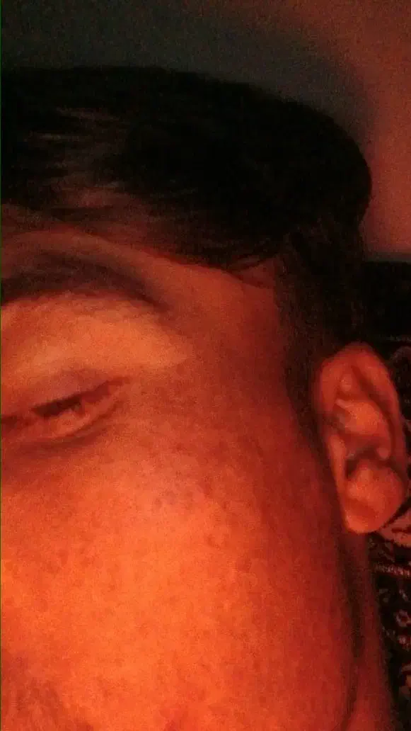 درمان لک|آرایشی، بهداشتی، درمانی|حسن آباد, |دیوار