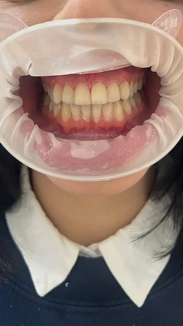 خدمات دندان پزشکی با متناسب شرایط و بودجه شما|خدمات آرایشگری و زیبایی|رودبار, |دیوار