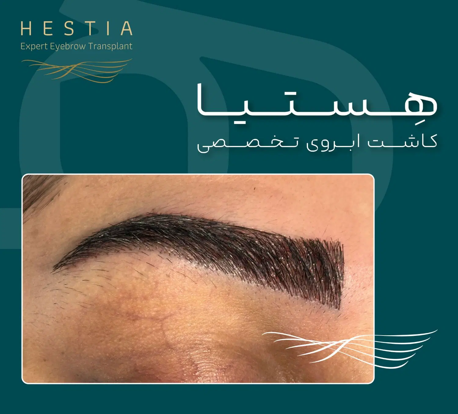 کاشت ابرو تخصصی هستیا / خدمات حرفهای/ نرخ منصفانه|خدمات زیبایی و سلامت|شیراز, ستارخان|دیوار
