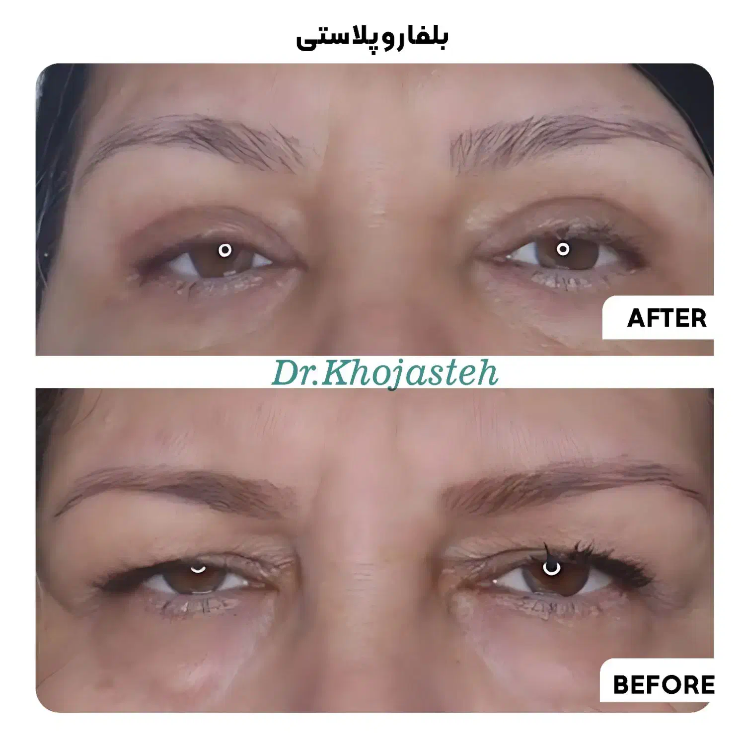 خدمات زیبایی اقساطی کلینیک دکتر خجسته|خدمات آرایشگری و زیبایی|گلبهار, شهر جدید گلبهار|دیوار