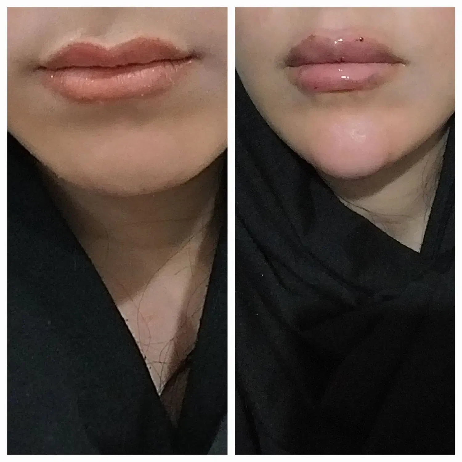 آف ژل و بوتاکس .مزو وآنزیم...|خدمات آرایشگری و زیبایی|ایذه, |دیوار