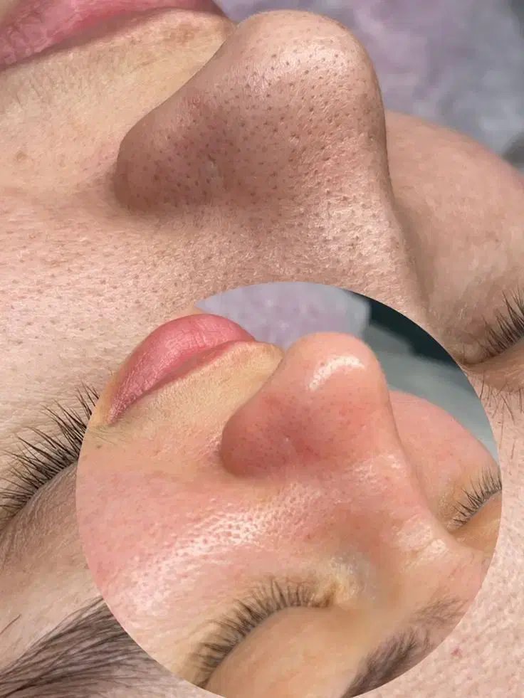 پاکسازی صورت|خدمات آرایشگری و زیبایی|آزادشهر, |دیوار