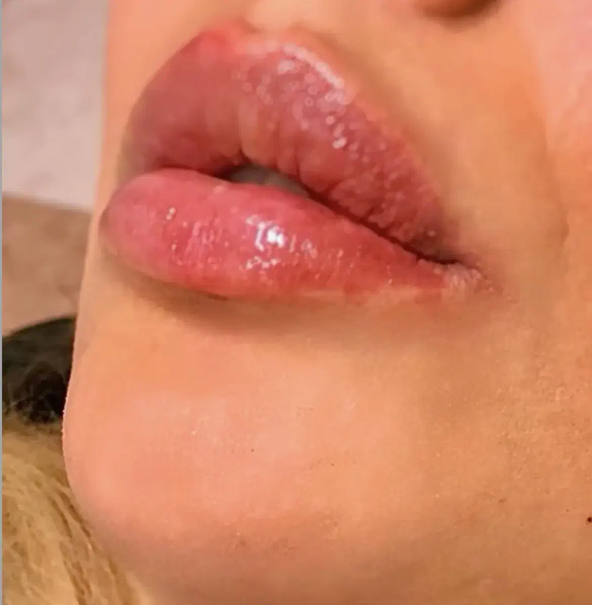 تخفیف ویژه افتتاحیه کلینیک زیبایی|خدمات آرایشگری و زیبایی|اردبیل, |دیوار