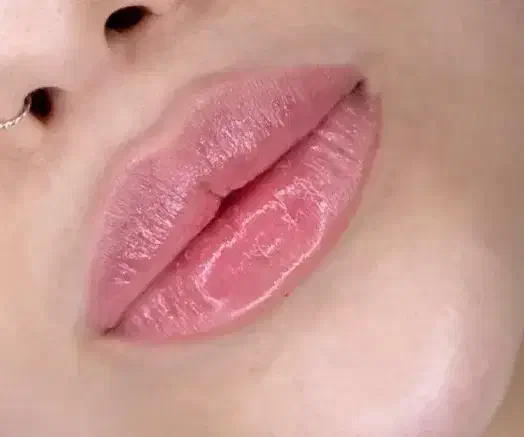 تزریق ژل فیلر و بوتاکس کل صورت ،ژل لب، چونه،گونه|خدمات آرایشگری و زیبایی|مشهد, ادیب نیشابوری (شهرک غرب)|دیوار