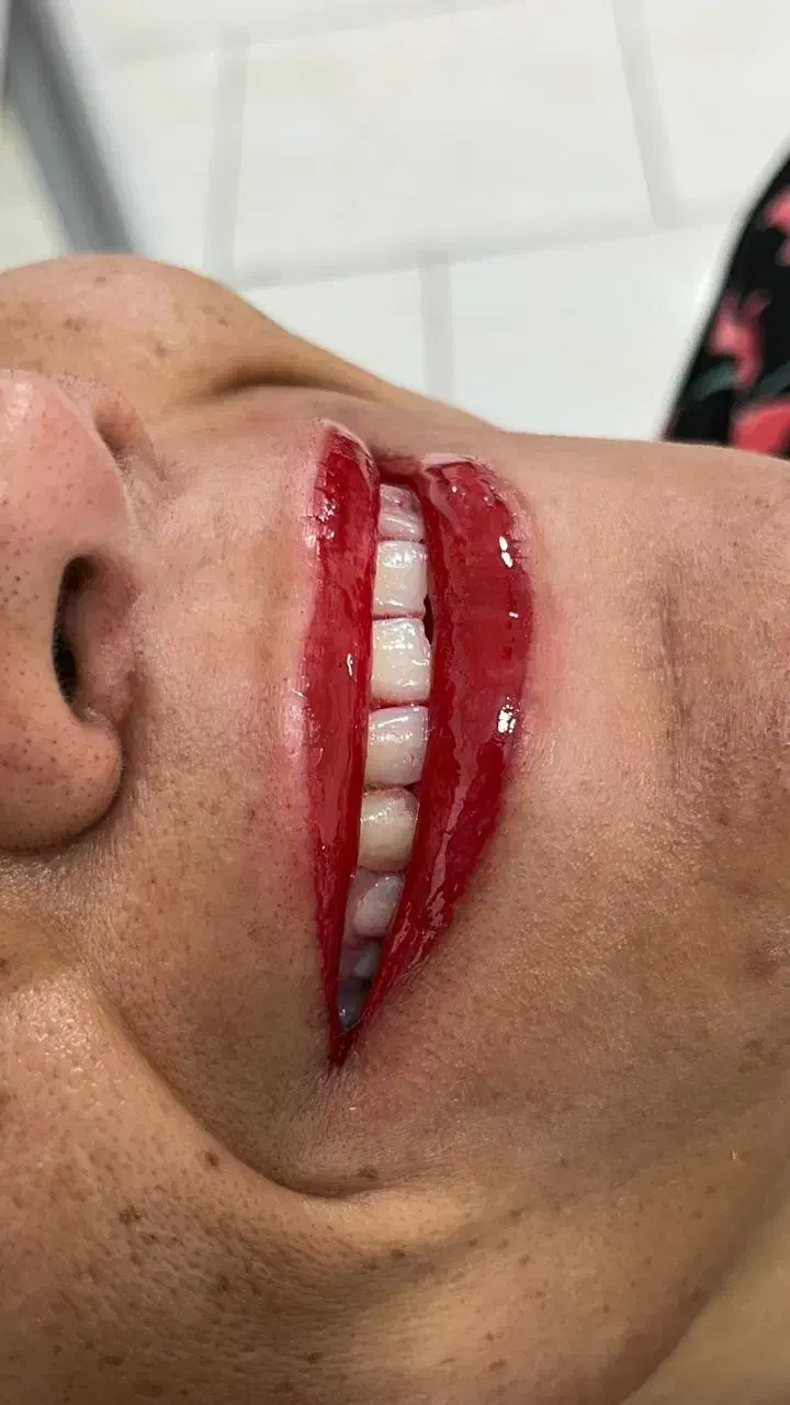 ۵۰ درصد تخفیف برای رفع تیرگی لب|خدمات آرایشگری و زیبایی|بندرعباس, |دیوار