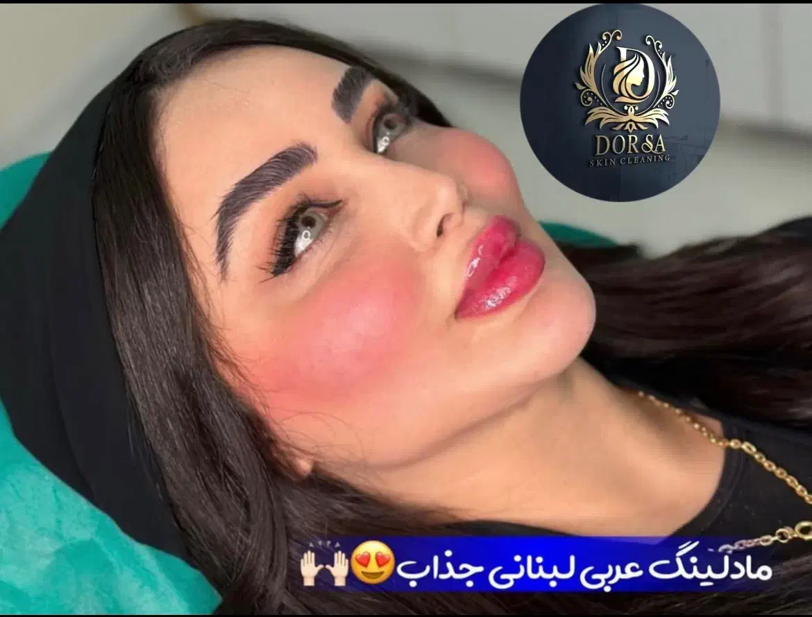 تزریق ژل و بوتاکس و مادلینگ خلیجی و هایفو درکلینیک|خدمات آرایشگری و زیبایی|کرمانشاه, |دیوار