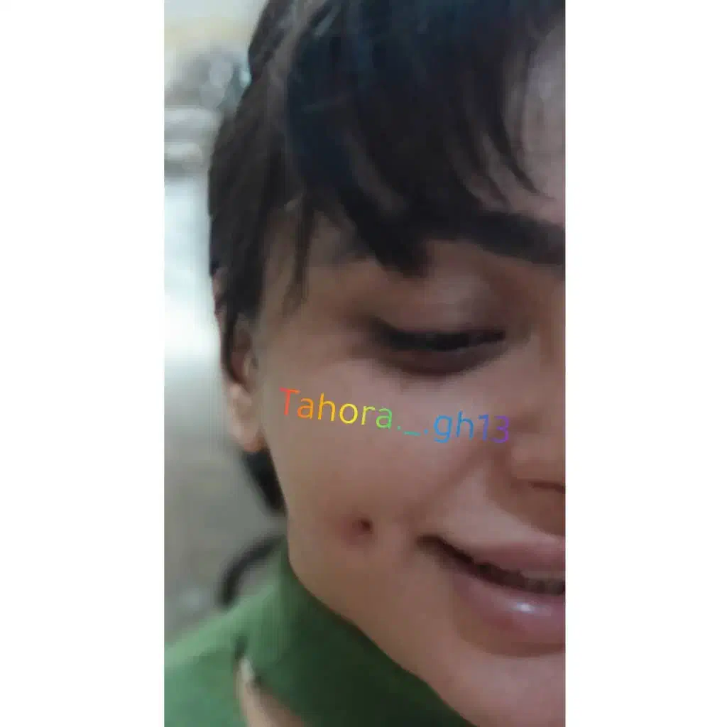 مدل ژل بوتاکس و پیرسینگ|خدمات آرایشگری و زیبایی|فولادشهر, مسکن مهر فولادشهر|دیوار