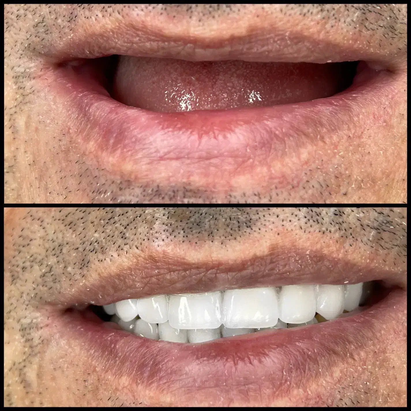 ایمپلنت مرکزی شیراز با متخصصین دکتر دانشور|خدمات زیبایی و سلامت|شیراز, معالیآباد|دیوار