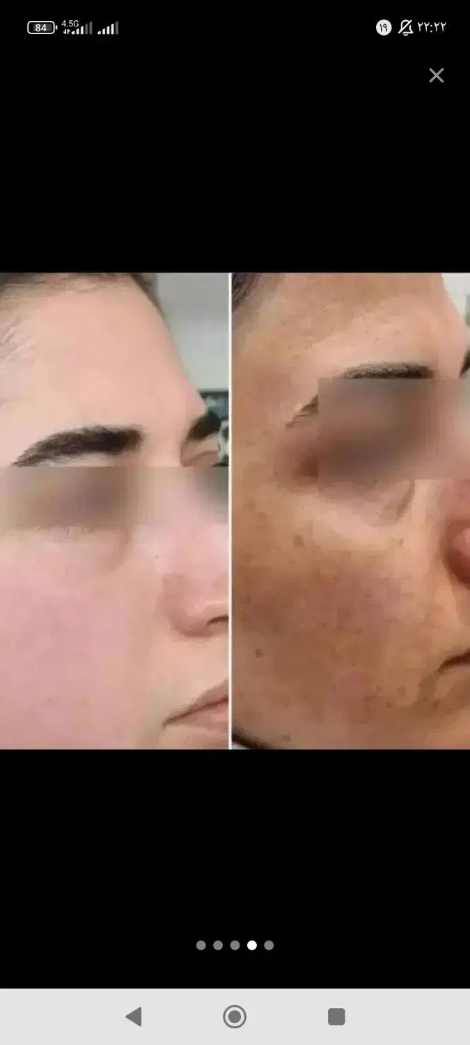 کرم معجزه اصل ۳عدد زیرقیمت|آرایشی، بهداشتی، درمانی|شیراز, شاپورجان|دیوار