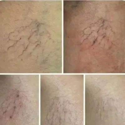 مدل ژل و بوتاکس و پوست و خدمات لیزر|خدمات زیبایی و سلامت|اصفهان, سعادتآباد|دیوار