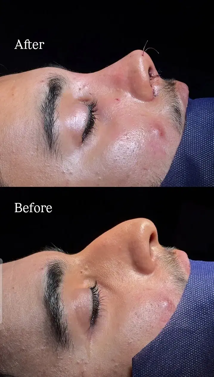 عمل بینی با چک صیادی مشاوره رایگان فوقتخصص ENT|خدمات زیبایی و سلامت|تهران, سهروردی|دیوار