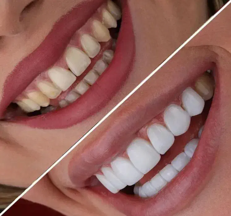 ارائه تمامی خدمات زیبایی با مناسب ترین قیمت|خدمات آرایشگری و زیبایی|تهران, دکتر هوشیار|دیوار