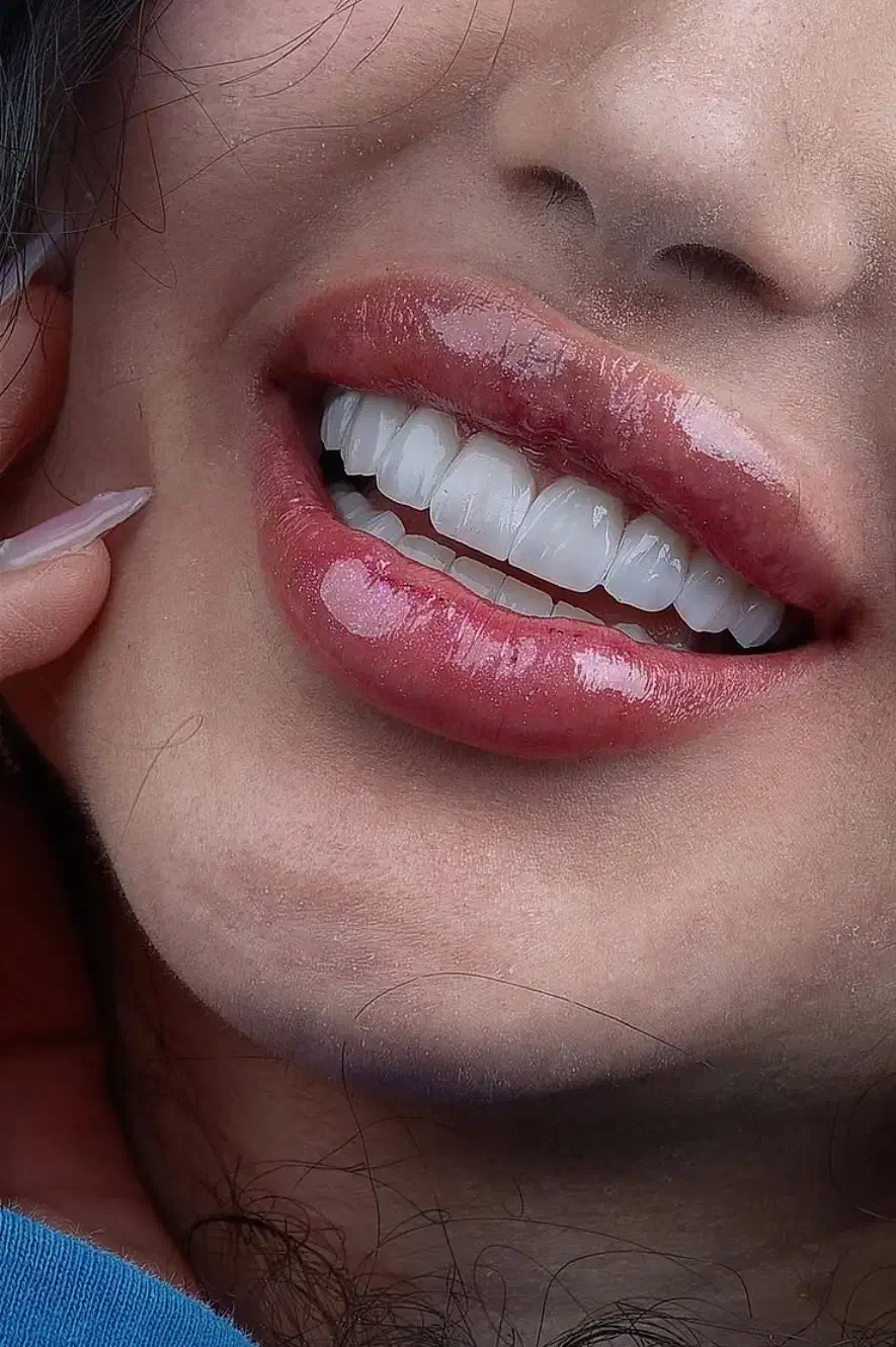 آموزش دندانسازی و کامپوزیت دندان|خدمات آموزشی|کرج, کوی کارمندان شمالی|دیوار