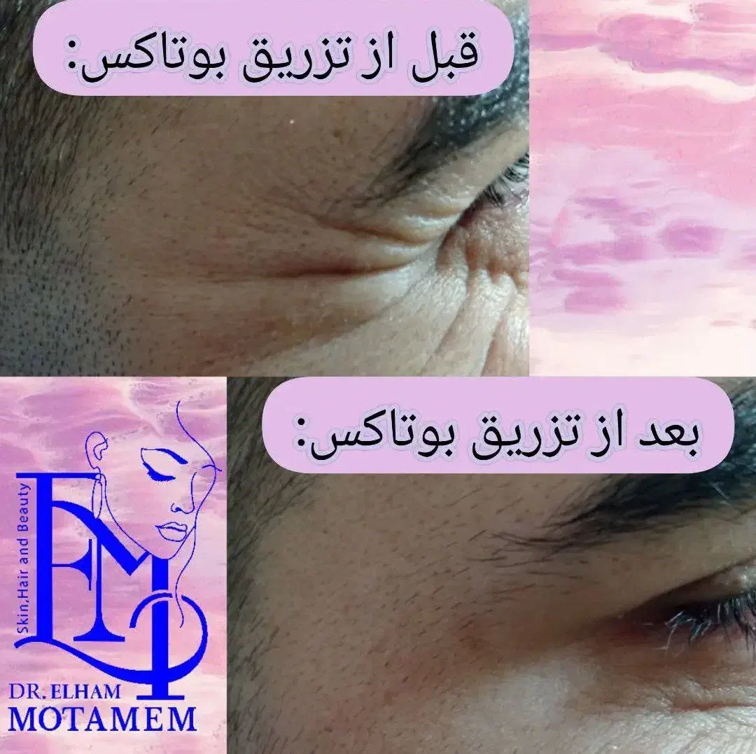 مطب پوست،مو،زیبایی دکتر الهام متمم|خدمات آرایشگری و زیبایی|رشت, گلسار|دیوار