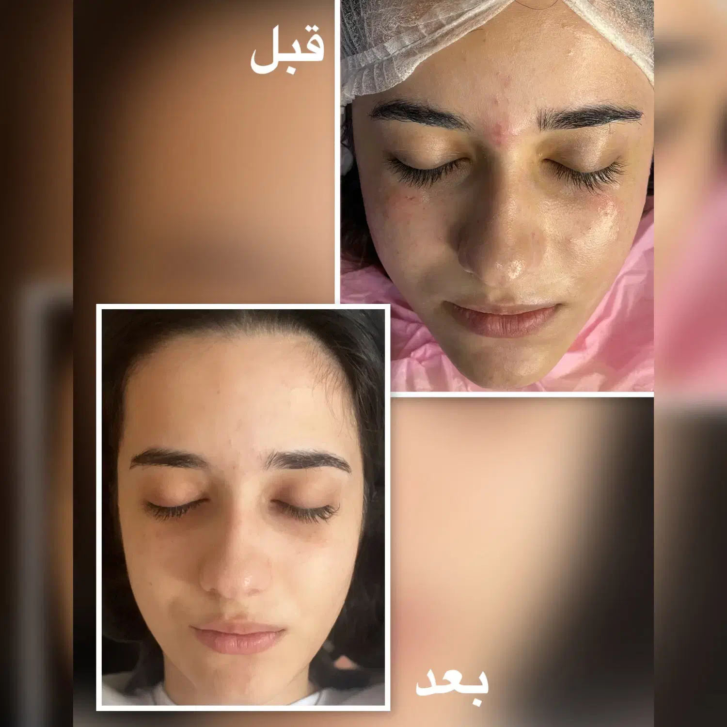 آموزش تخصصی فیشیال با مدرک فنی و حرفه ای|خدمات آموزشی|تبریز, |دیوار