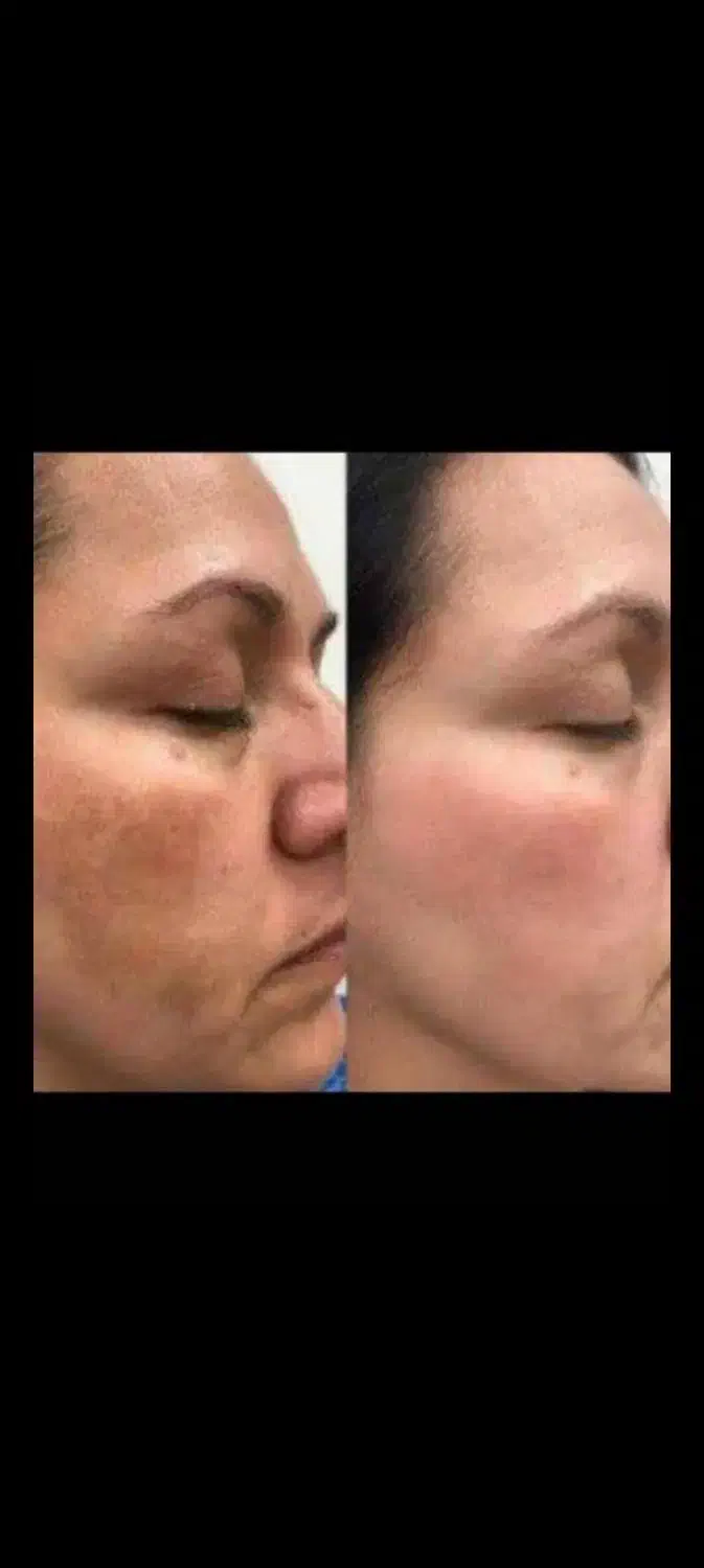 کرم سفید کننده شب (آنتی استاین )ترکیب آمپولی|آرایشی، بهداشتی، درمانی|بم, |دیوار