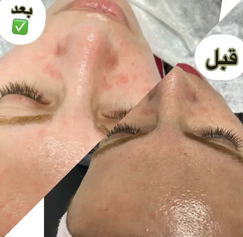 پاکسازی پوست و فشیال و لیفت ابرو ومژه|خدمات آرایشگری و زیبایی|سیاهکل, |دیوار