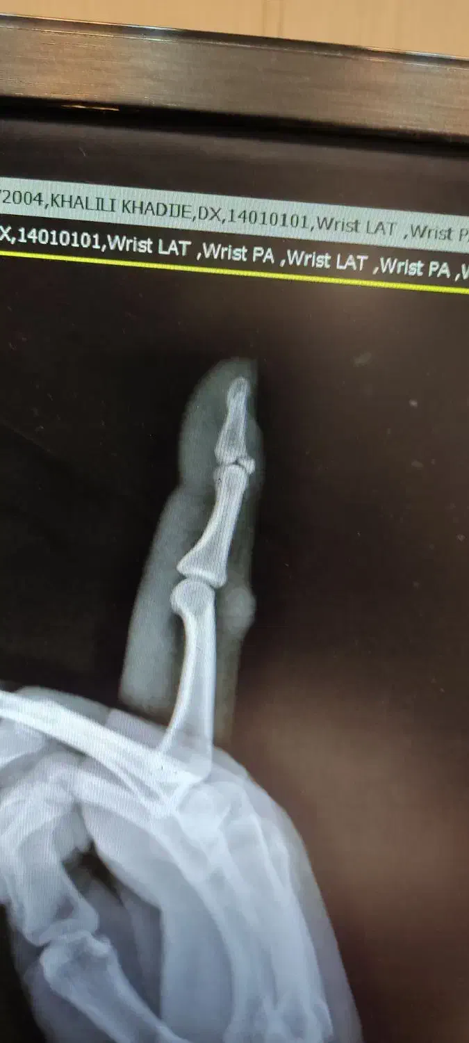 مراقبت از بیمار|استخدام درمانی، زیبایی، بهداشتی|رشت, معلم|دیوار