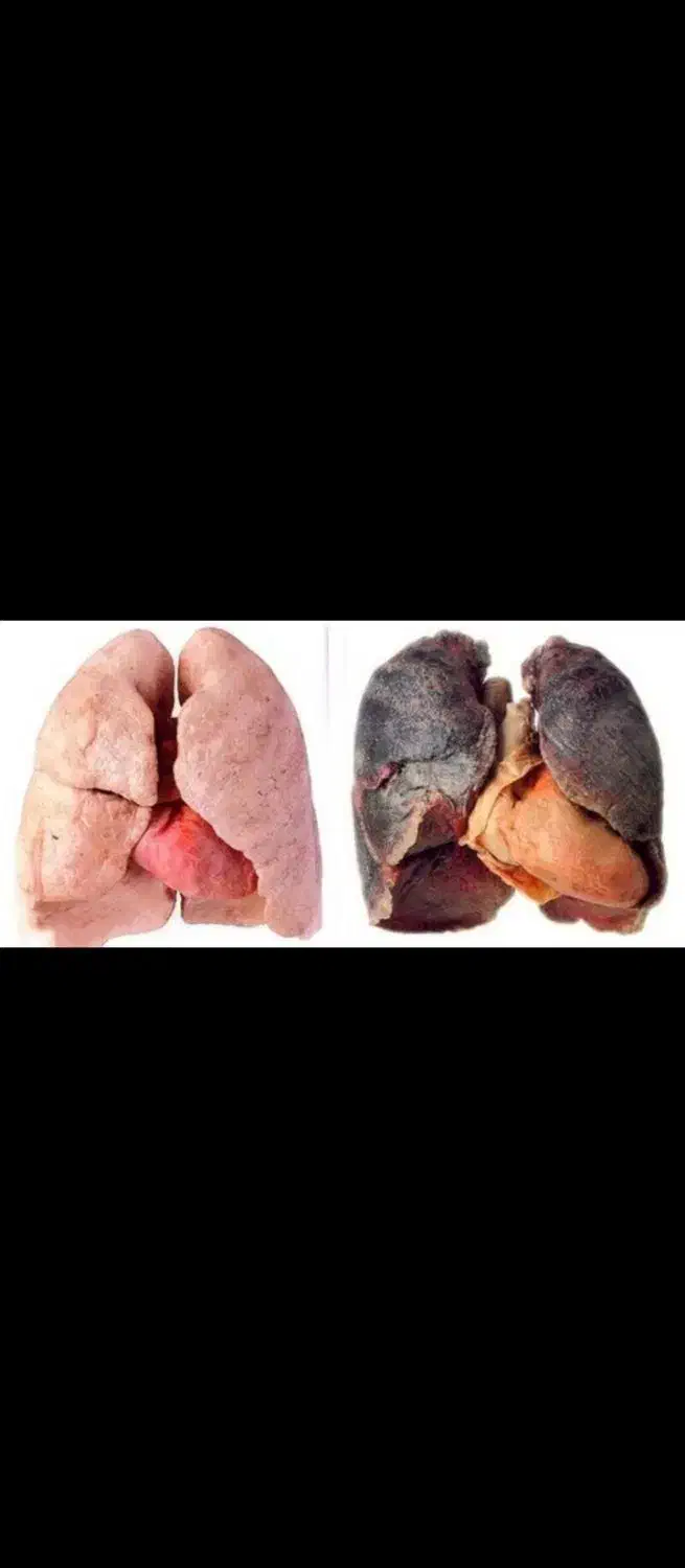 پاکسازی ریه|آرایشی، بهداشتی، درمانی|میبد, |دیوار