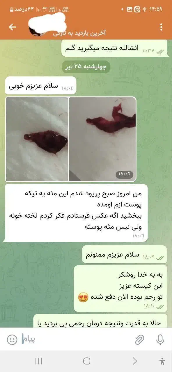 مشاوره داوطلبانه کیست سینه ورحم،تنبلی،تخمدان،|فعالیت داوطلبانه|اردبیل, |دیوار