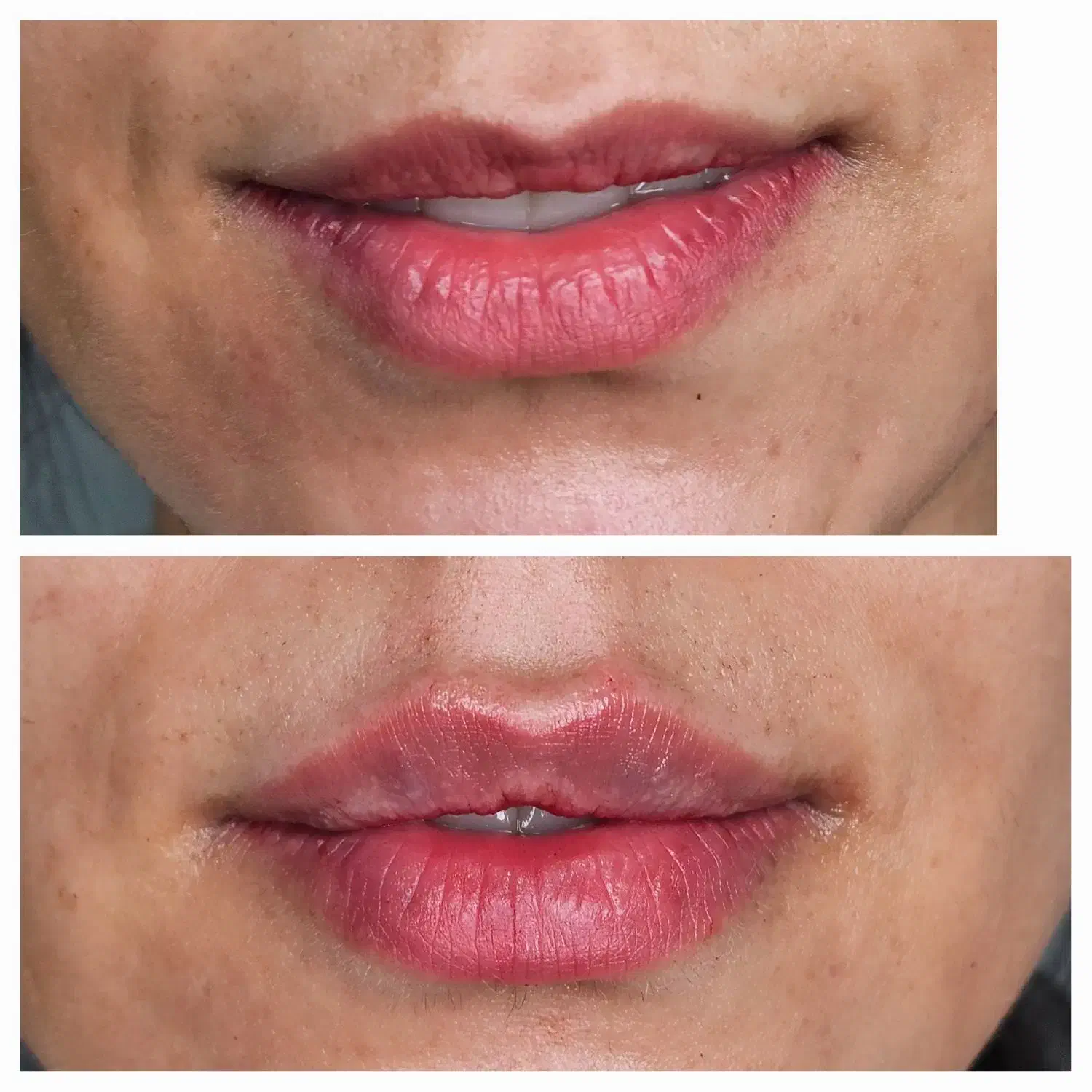 کلینیک رویال دورود|خدمات آرایشگری و زیبایی|دورود, |دیوار