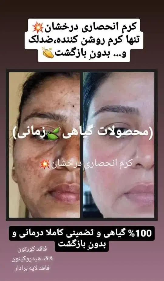 کرم چند کاره درخشان کاملا انحصاری و بدون بازگشت|حراج|خرمآباد, |دیوار