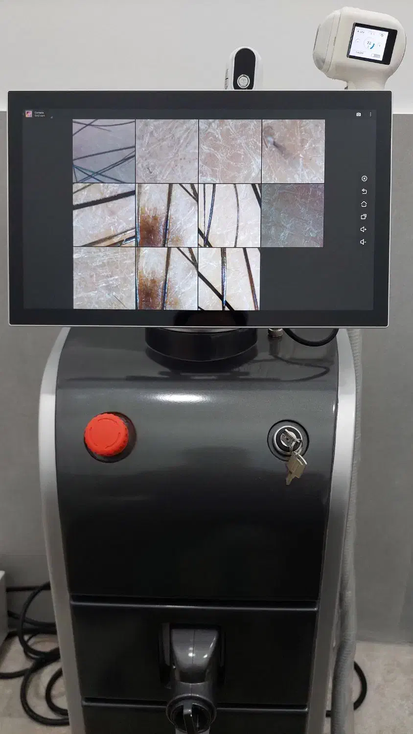 دستگاه لیزر مو زاید مولتی تک|پزشکی|کرج, عظیمیه|دیوار