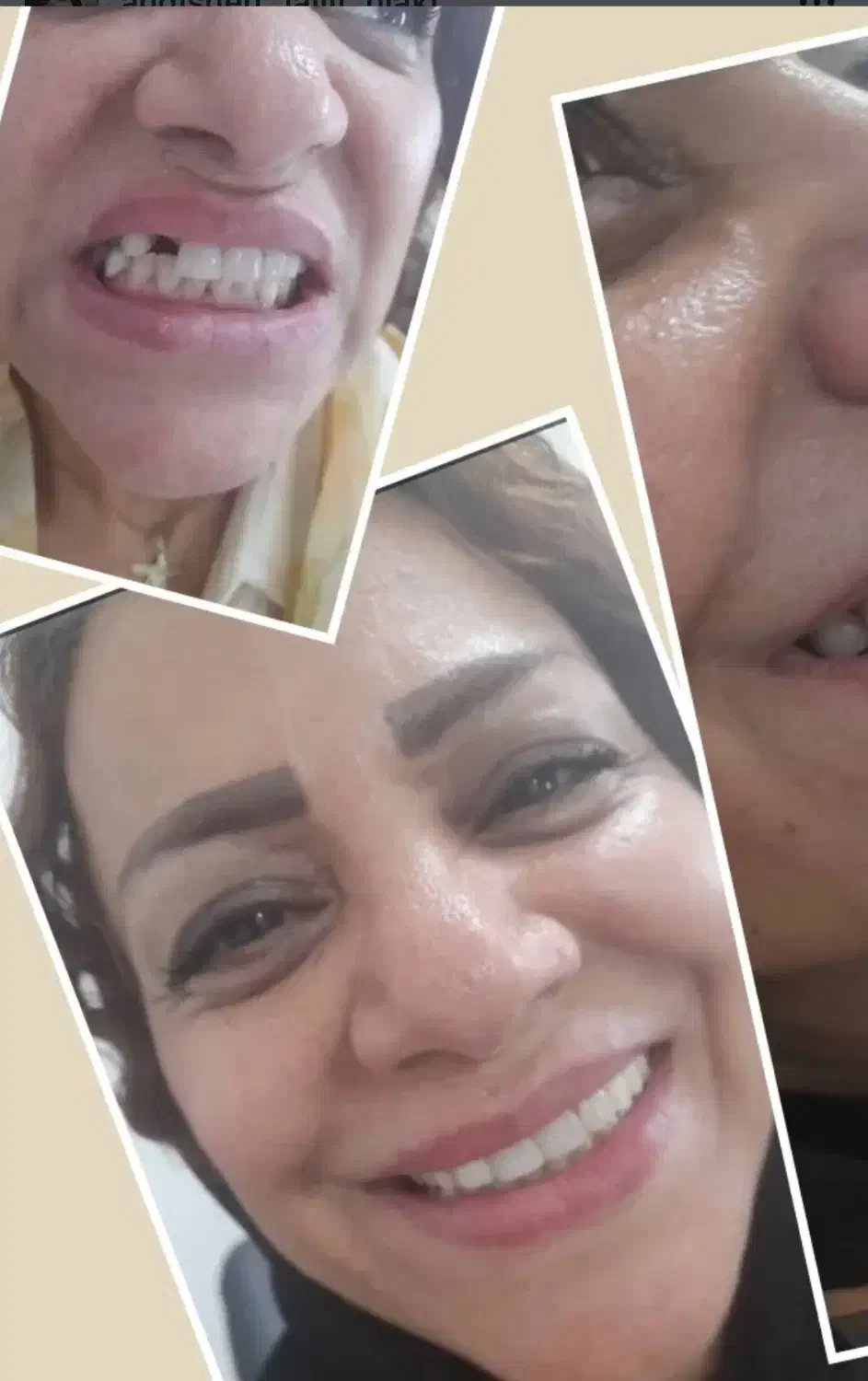 ساخت پروتز متحرک|آرایشی، بهداشتی، درمانی|آمل, |دیوار