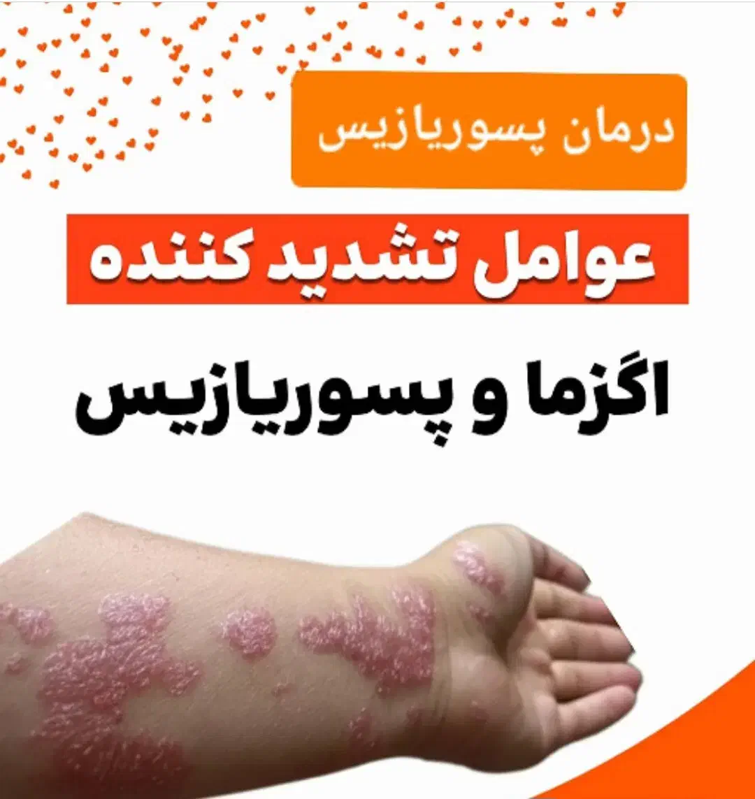 پماد اگزما پسو|آرایشی، بهداشتی، درمانی|مراغه, |دیوار