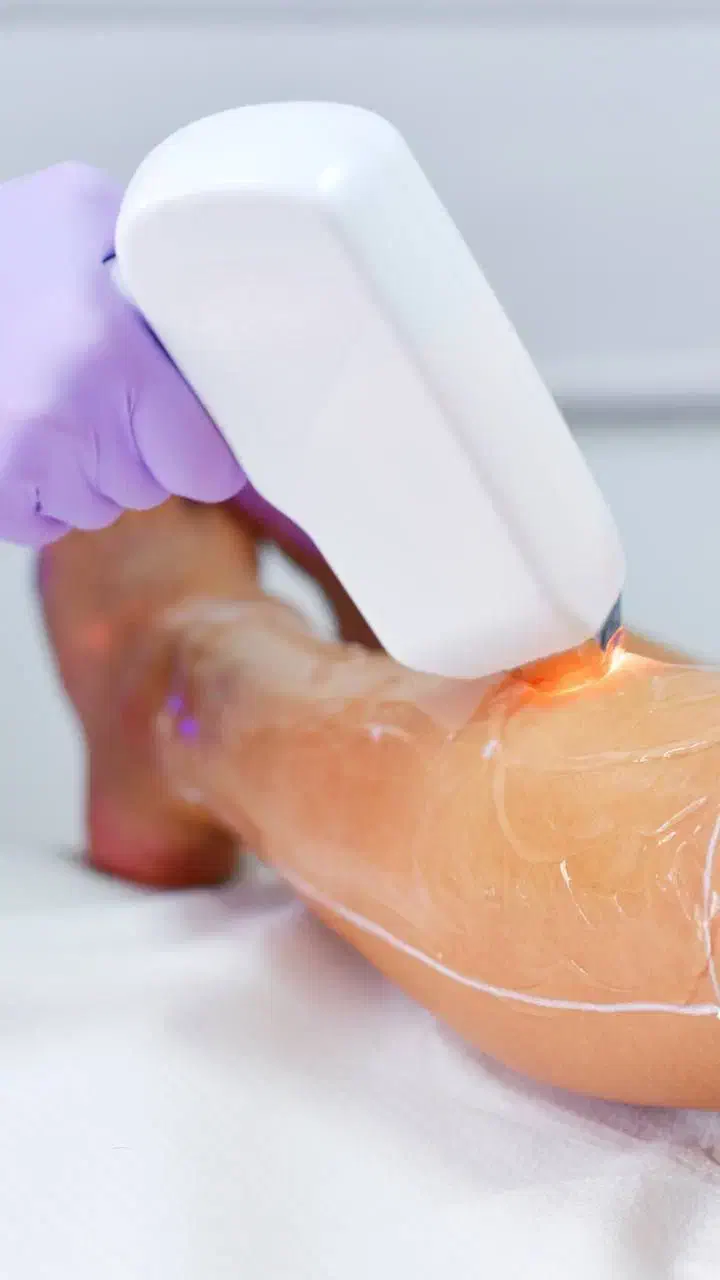 یلدای بدون مو....|خدمات آرایشگری و زیبایی|شهرکرد, |دیوار