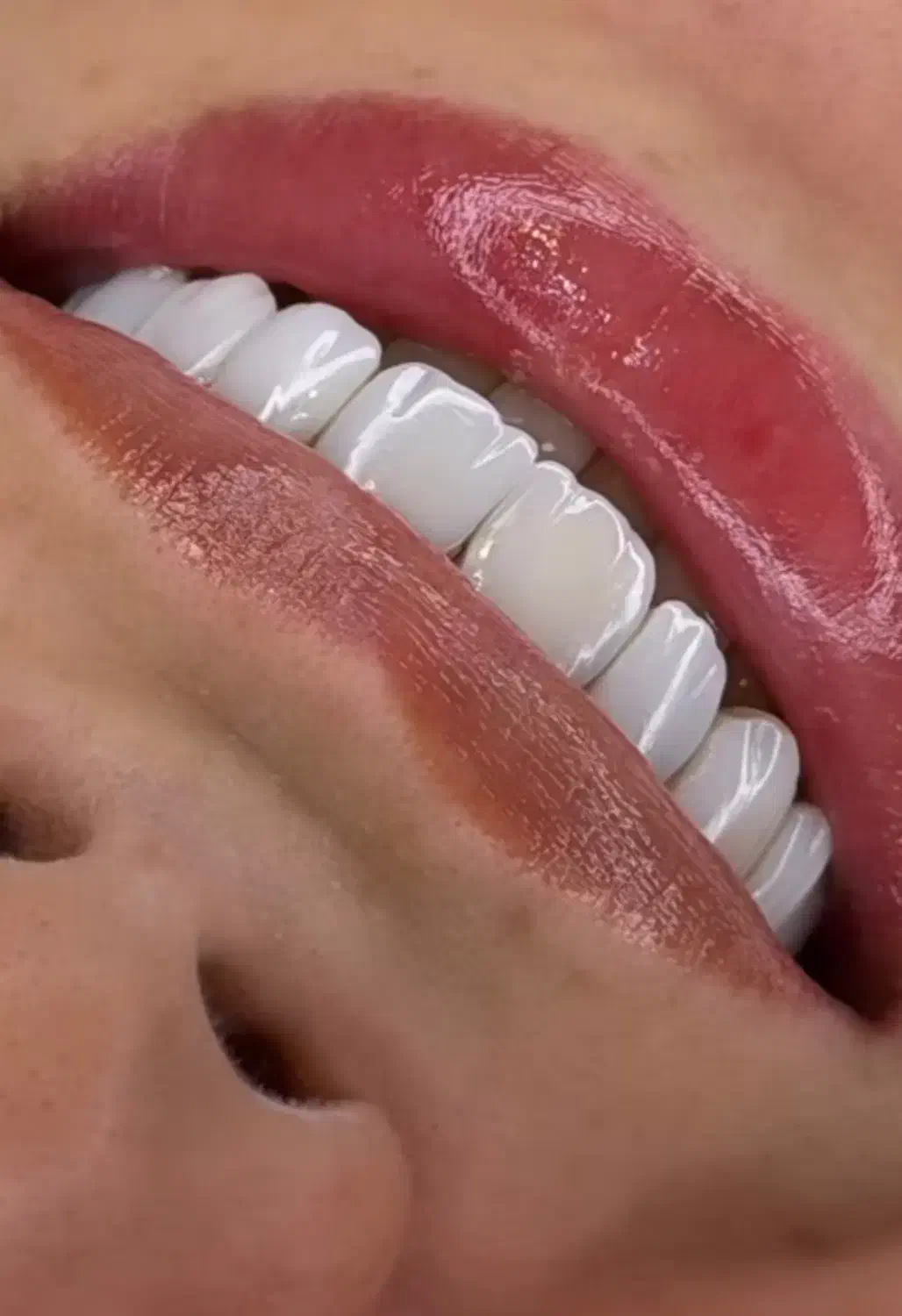 کامپوزیت دندان|خدمات آرایشگری و زیبایی|پرند, فاز ۱|دیوار