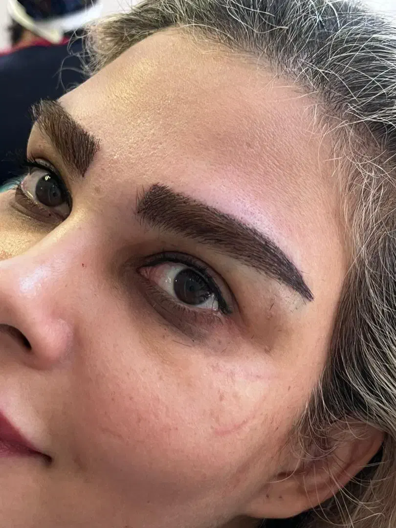 کاشت مو و ابرو|آرایشی، بهداشتی، درمانی|کرج, دانشگاه هنر تهران (پردیس کرج)|دیوار