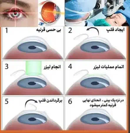 ضعیفی چشم|فعالیت داوطلبانه|قم, ولیعصر|دیوار