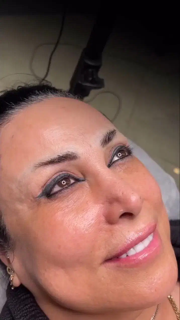 مدل برای ریمو تک جلسه ای تتو قدیمی|خدمات آرایشگری و زیبایی|نوشهر, |دیوار