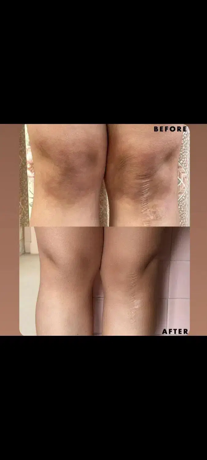 بلک فرایدی وایتنینگ تخصصی بیکینی زیربغل زانو|خدمات آرایشگری و زیبایی|رشت, رودباری|دیوار